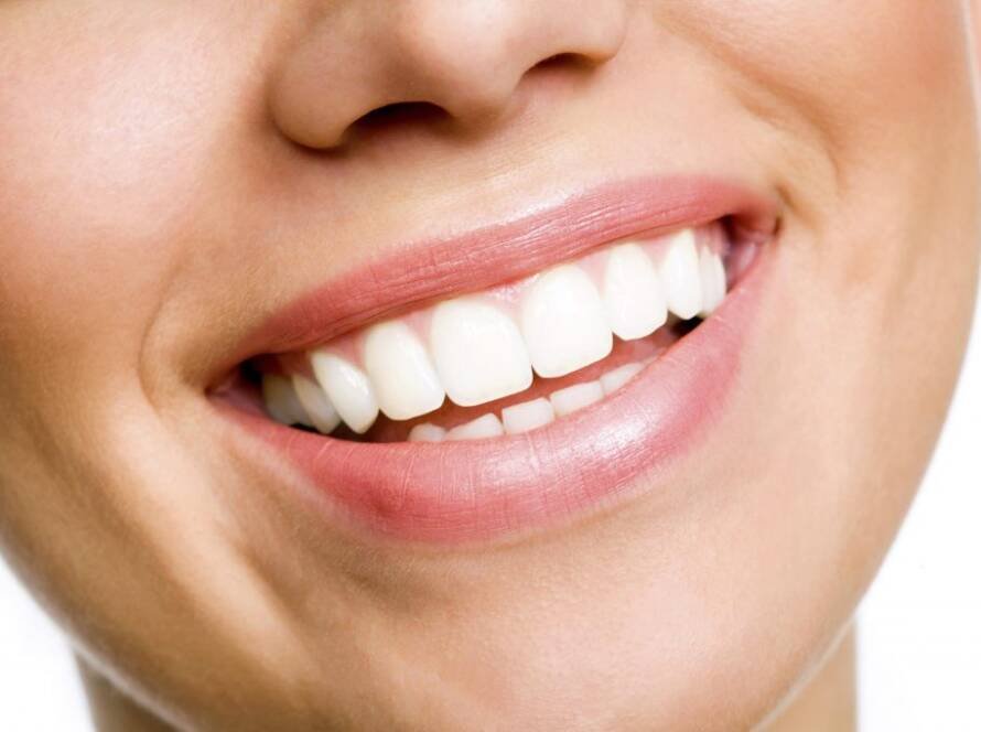 Teeth Whitening Procedure